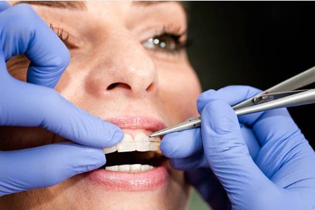 Qu’est-ce que l’orthodontie ?