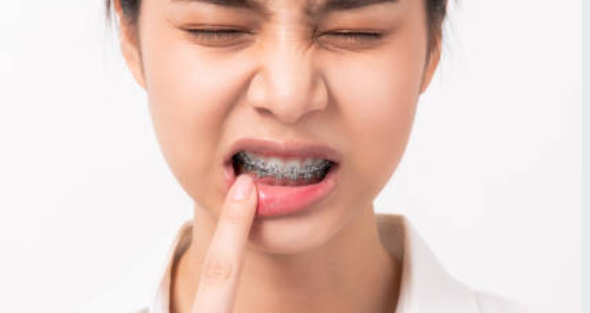 Urgences et incidents courants